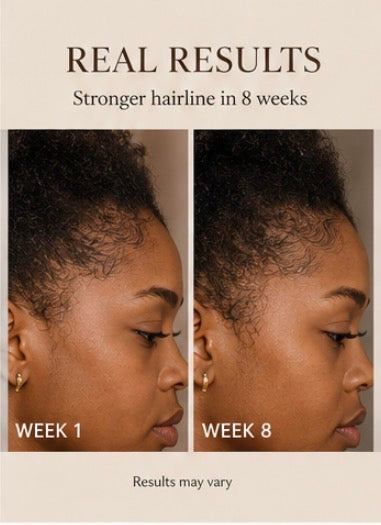 Nourie Beauty Hairline Growth Oil